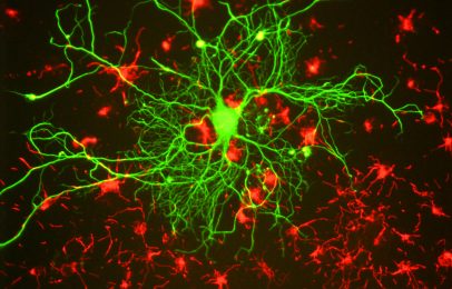 The Problem of Pain: Brain imaging and religion
